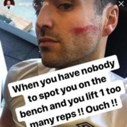 Mark Wright's gym injury (c) Instagram