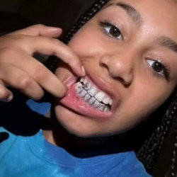 North West has flaunted a set of diamond teeth grills after her dad Kanye West showed off his metallic ‘dentures’