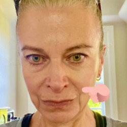 Ricky Gervais’ long-term partner Jane Fallon has opened up about a ‘worrying’ skin cancer scare