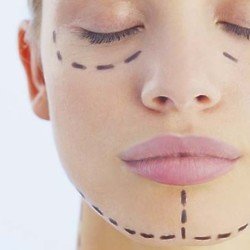 10 questions to ask yourself before having cosmetic surgery